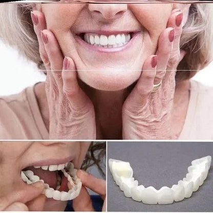 Carillas Plasticas Snapon Smile